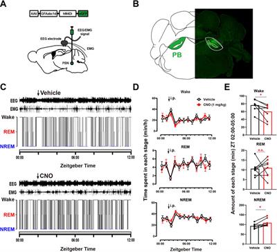 Parabrachial nucleus astrocytes regulate wakefulness and isoflurane anesthesia in mice